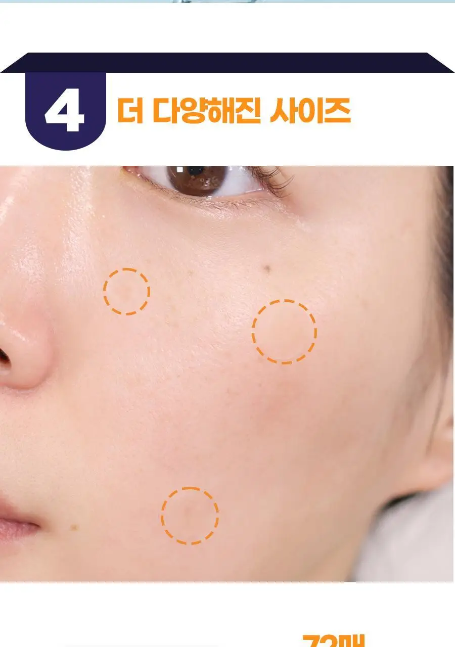 [위클리초특가/의료기기] 케어플러스 상처 커버 UV 차단 스팟 패치 72매 [점뺀 후 사용가능] 상세페이지 18